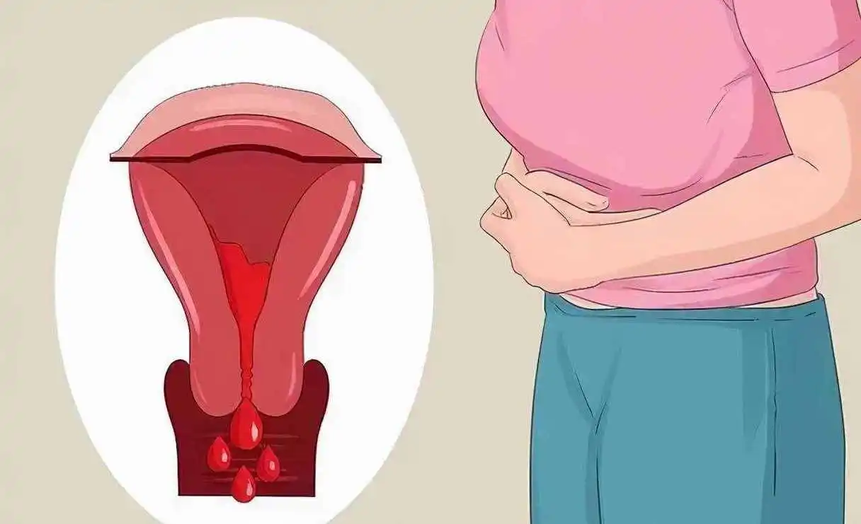 子宮內膜的厚薄對女性有什麼影響