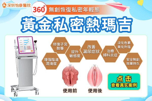 深圳熱瑪吉收陰機邊間好？熱瑪吉陰道緊緻效果有幾耐？